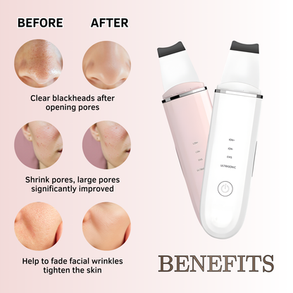 Ultrasonic Skin Scrubber